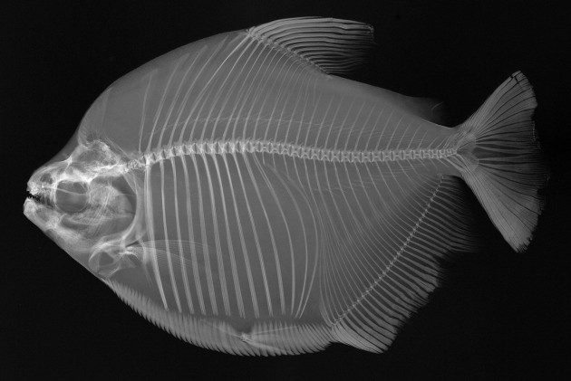 Balıkların X-Ray Görüntüleri: Mylossoma duriventre